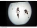 Plankton unter dem Mikroskop