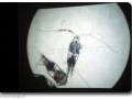 Plankton unter dem Mikroskop