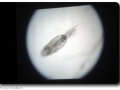Plankton unter dem Mikroskop